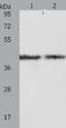 Aldolase, Fructose-Bisphosphate A antibody, TA321044, Origene, Western Blot image 