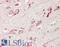 Adenylate cyclase type 5 antibody, LS-B14504, Lifespan Biosciences, Immunohistochemistry paraffin image 