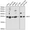 Ribosomal Protein S7 antibody, A6731, ABclonal Technology, Western Blot image 