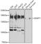 Histone-lysine N-methyltransferase EHMT1 antibody, 23-633, ProSci, Western Blot image 