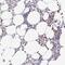 Melanoma-associated antigen C3 antibody, NBP2-14757, Novus Biologicals, Immunohistochemistry paraffin image 