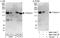Dynactin Subunit 1 antibody, NBP1-71829, Novus Biologicals, Western Blot image 