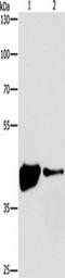 Mitogen-activated protein kinase 11 antibody, TA350770, Origene, Western Blot image 
