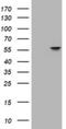 ATPase H+ Transporting V1 Subunit B2 antibody, NBP2-45525, Novus Biologicals, Western Blot image 