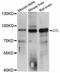 Denticleless protein homolog antibody, abx125788, Abbexa, Western Blot image 