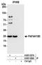 Platelet Activating Factor Acetylhydrolase 1b Catalytic Subunit 3 antibody, A305-527A, Bethyl Labs, Immunoprecipitation image 