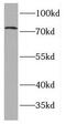 FAST Kinase Domains 2 antibody, FNab03020, FineTest, Western Blot image 