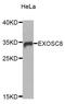 Exosome complex exonuclease RRP43 antibody, orb373240, Biorbyt, Western Blot image 
