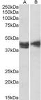 Interleukin-3 receptor subunit alpha antibody, TA348953, Origene, Western Blot image 