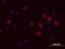 LYN Proto-Oncogene, Src Family Tyrosine Kinase antibody, AF3206, R&D Systems, Immunofluorescence image 