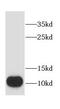 Coiled-Coil-Helix-Coiled-Coil-Helix Domain Containing 7 antibody, FNab01639, FineTest, Western Blot image 