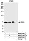 Probable ATP-dependent RNA helicase DDX5 antibody, A300-523A, Bethyl Labs, Immunoprecipitation image 