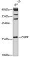 Calcitonin Related Polypeptide Alpha antibody, GTX53926, GeneTex, Western Blot image 