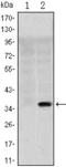 Solute Carrier Family 22 Member 1 antibody, GTX80400, GeneTex, Western Blot image 