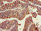Tripartite Motif Containing 54 antibody, LS-C679894, Lifespan Biosciences, Immunohistochemistry paraffin image 