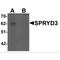 SPRY Domain Containing 3 antibody, MBS150301, MyBioSource, Western Blot image 