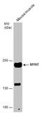 Myosin-7 antibody, GTX100713, GeneTex, Western Blot image 