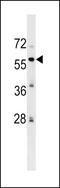 Zinc finger protein 82 antibody, LS-C157407, Lifespan Biosciences, Western Blot image 