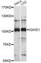 DDB1- and CUL4-associated factor 6 antibody, LS-C749288, Lifespan Biosciences, Western Blot image 