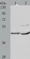 Neutral cholesterol ester hydrolase 1 antibody, TA323968, Origene, Western Blot image 
