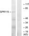 Adhesion G Protein-Coupled Receptor F4 antibody, TA316254, Origene, Western Blot image 