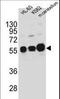 Calcium/Calmodulin Dependent Protein Kinase IG antibody, LS-C100804, Lifespan Biosciences, Western Blot image 