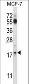P27 antibody, LS-C161523, Lifespan Biosciences, Western Blot image 