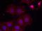 ERBB2 antibody, NB100-81961, Novus Biologicals, Immunofluorescence image 