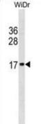 Histone Cluster 2 H2B Family Member E antibody, abx031321, Abbexa, Western Blot image 