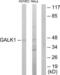 Galactokinase antibody, LS-C118919, Lifespan Biosciences, Western Blot image 