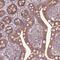 Zinc Finger Protein 57 antibody, NBP1-94138, Novus Biologicals, Immunohistochemistry frozen image 