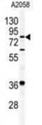 Acylaminoacyl-Peptide Hydrolase antibody, abx026887, Abbexa, Western Blot image 
