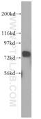 Poly(A)-Specific Ribonuclease antibody, 13799-1-AP, Proteintech Group, Western Blot image 