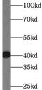 Interleukin-17F antibody, FNab04229, FineTest, Western Blot image 