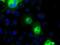 Cadherin 13 antibody, NBP2-02528, Novus Biologicals, Immunocytochemistry image 