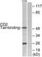 CD2 Cytoplasmic Tail Binding Protein 2 antibody, TA315051, Origene, Western Blot image 