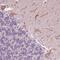 Cadherin EGF LAG seven-pass G-type receptor 3 antibody, HPA062866, Atlas Antibodies, Immunohistochemistry paraffin image 