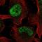 Zinc Finger And BTB Domain Containing 38 antibody, NBP2-55733, Novus Biologicals, Immunofluorescence image 