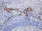 Ribophorin II antibody, M05006, Boster Biological Technology, Immunohistochemistry paraffin image 