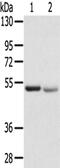 Solute Carrier Family 8 Member B1 antibody, PA5-51259, Invitrogen Antibodies, Western Blot image 