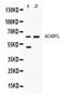 Very long-chain specific acyl-CoA dehydrogenase, mitochondrial antibody, LS-C662311, Lifespan Biosciences, Western Blot image 