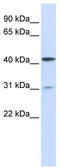 HAT antibody, TA339401, Origene, Western Blot image 