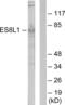 EPS8 Like 1 antibody, abx013718, Abbexa, Western Blot image 