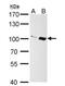 Importin 13 antibody, NBP1-31508, Novus Biologicals, Western Blot image 
