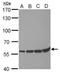 PR/SET Domain 14 antibody, MA5-27847, Invitrogen Antibodies, Western Blot image 