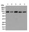 Aconitase 1 antibody, ab126595, Abcam, Western Blot image 