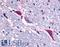 NK-3R antibody, LS-A4147, Lifespan Biosciences, Immunohistochemistry paraffin image 