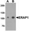 Endoplasmic Reticulum Aminopeptidase 1 antibody, TA326650, Origene, Western Blot image 