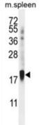Zinc Finger Protein 593 antibody, abx026593, Abbexa, Western Blot image 
