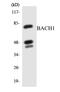 BTB Domain And CNC Homolog 1 antibody, EKC1624, Boster Biological Technology, Western Blot image 